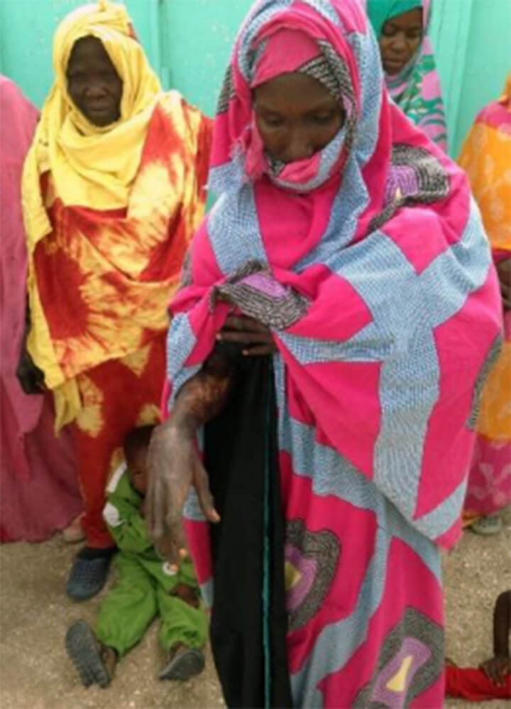 Centre traitant les malades de la lèpre en Mauritanie soutenu par la Fondation.