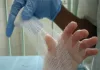 La Fondation Française de l’Ordre de Malte, partenaire de la Fondation René Touraine pour offrir des soins adaptés aux enfants souffrant de maladies de la peau L'épidermolyse bulleuse se caractérise par des atteintes cutanées : formation de bulles au niveau des différentes couches de l'épiderme